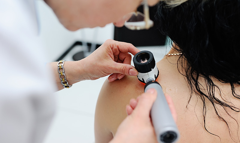 Skin Cancer Risks, Signs, Symptoms & Screening