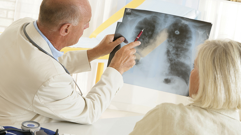 Lung Cancer Signs