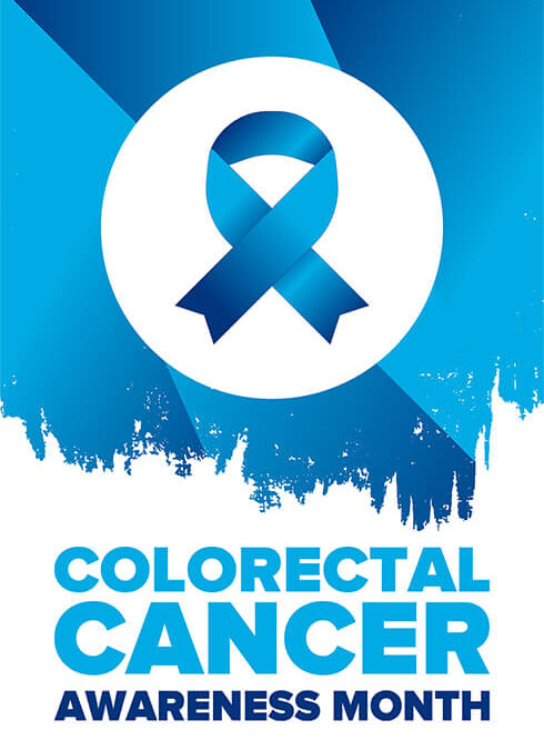 Are You at Risk for Colorectal Cancer?
